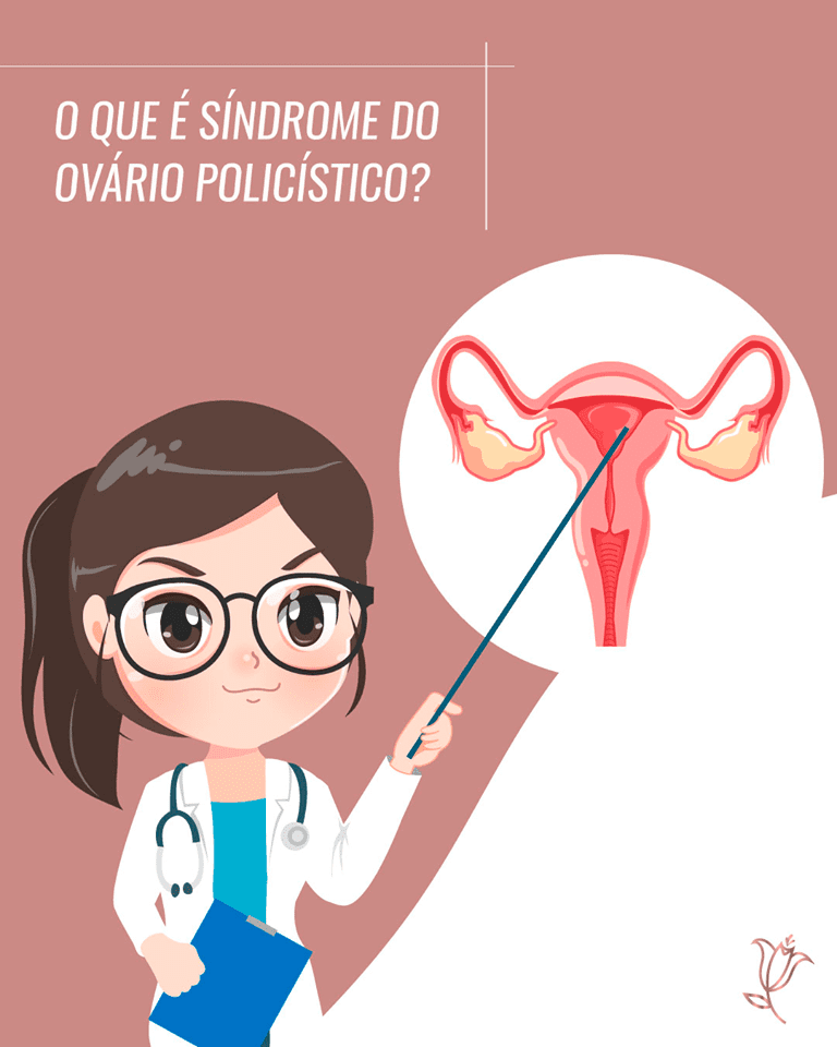 o que é sindrome do ovário policístico?