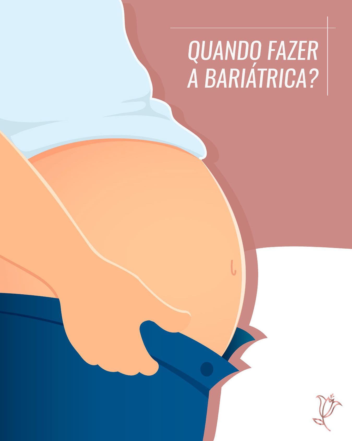 quando fazer a bariátrica?