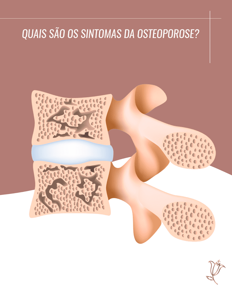 quais são os sintomas da osteoporose?